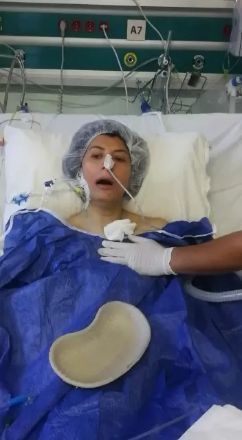 Yeni akciğer ile ilk nefes, o anlar böyle kaydedildi