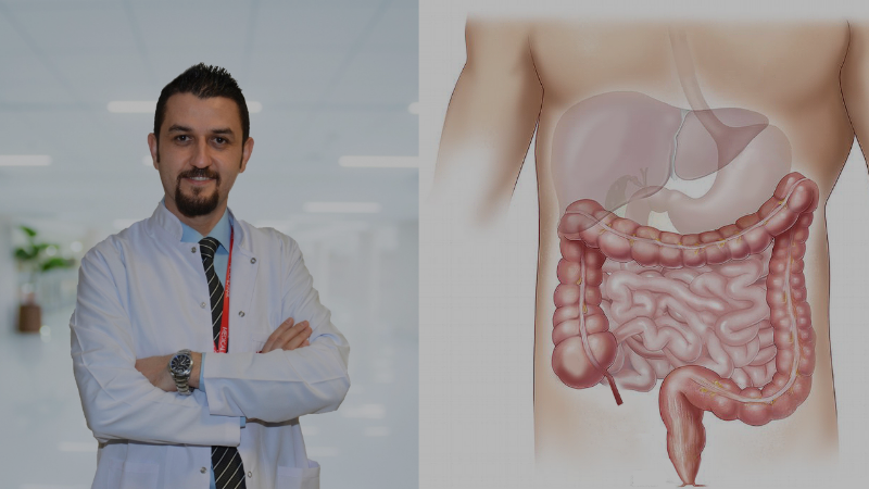 Bu sendroma dikkat: Bir karın ağrısından fazla