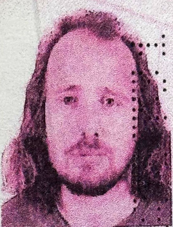 İngiliz vatandaşı, Türkiye’de saç ekimi ve diş tedavisi ardından hayatını kaybetti