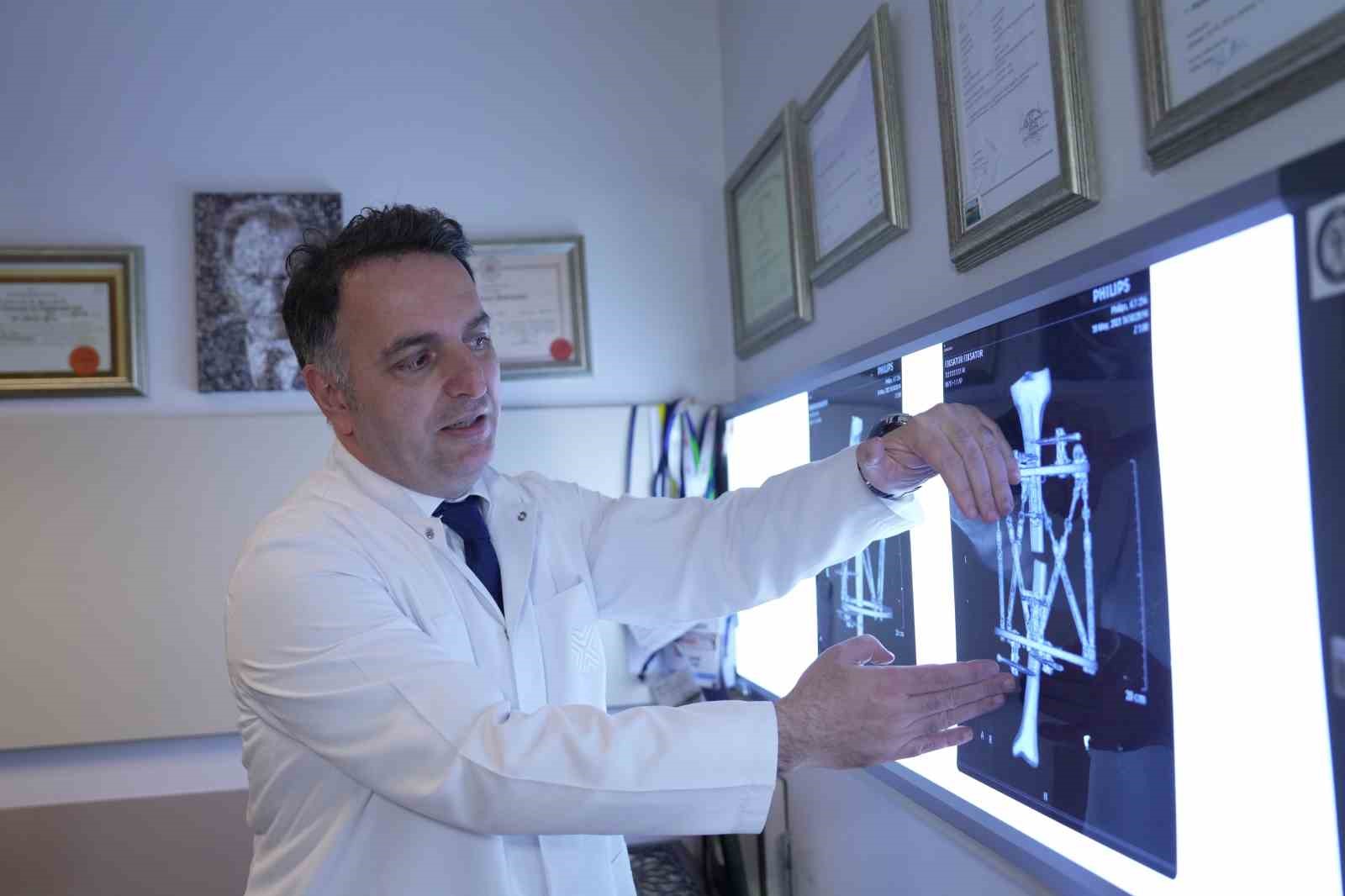 Boy kısalığına karşı modern çözüm: kemik uzatma yöntemleri
