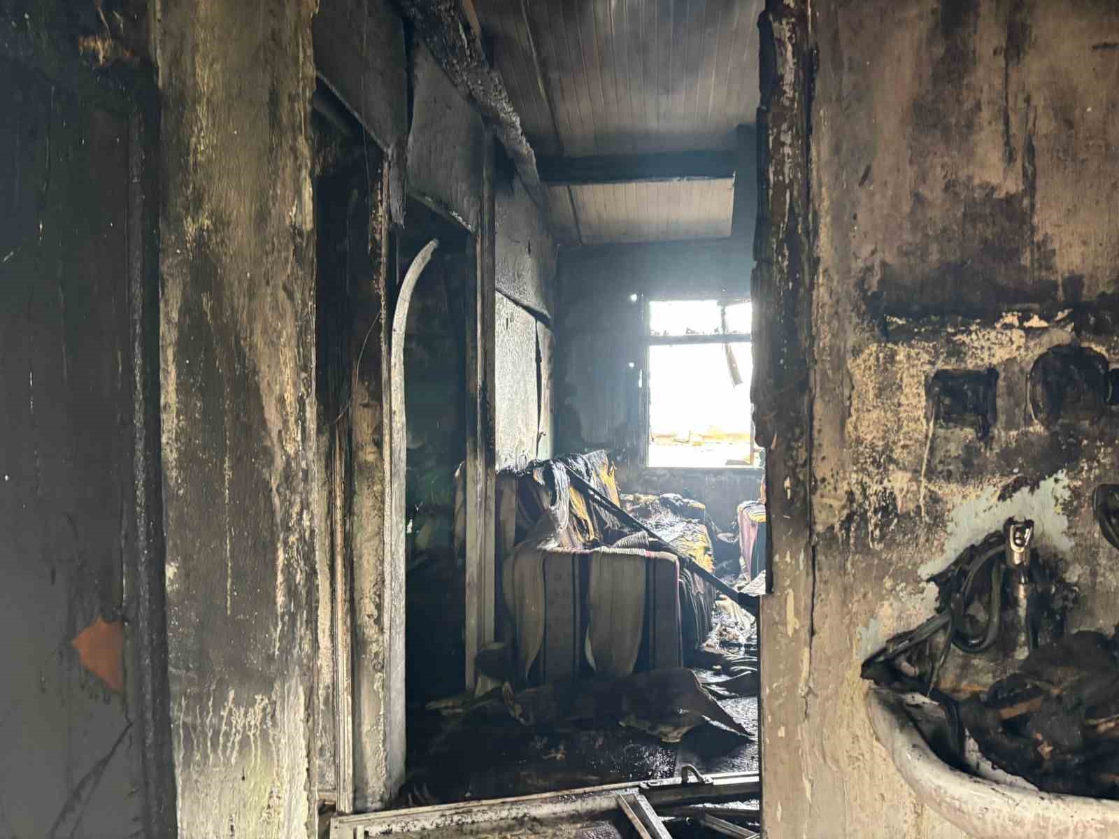 Yangında hayatını kaybetti: 2 ay önce bacakları ampute edilmiş