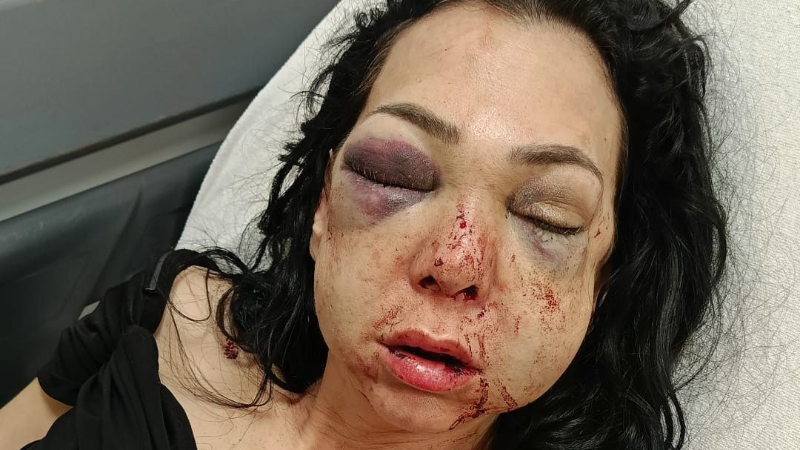 Evladının yanında bu hale getirdiler