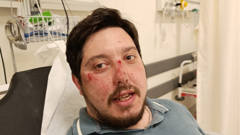 Bakımsız yol nedeniyle kaza geçirdi