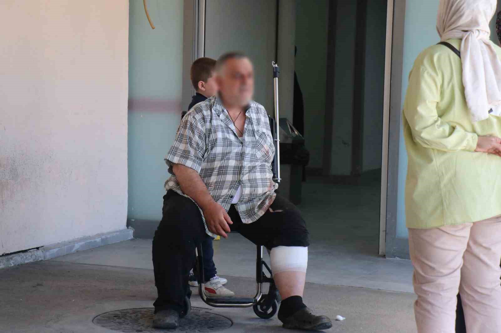 Sakarya’da acemi kasaplar acilleri doldurdu: "Amca beni yaktın"
