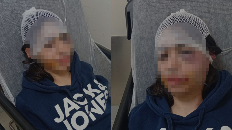 Ayrılık kararını kabullenemeyip kız arkadaşını darbeden sanık: "Çok üzgünüm"